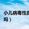 小儿病毒性皮疹会传染吗（病毒性皮疹会传染吗）