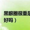 黑眼圈很重是肾不好吗女(黑眼圈很重是肾不好吗) 黑眼圈很重是肾不好吗女(黑眼圈很重是肾不好吗)