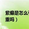 紫癫是怎么引起的严重吗（紫癫是什么病 严重吗）