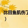 比目鱼肌伤了怎么治（比目鱼肌拉伤怎么恢复）