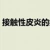接触性皮炎的症状图片（接触性皮炎的症状）