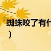 蜘蛛咬了有什么症状吗（蜘蛛咬了有什么症状）