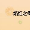 焰红之痛塔杖id（焰红之痛塔杖）