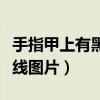 手指甲上有黑色线是怎么回事（手指甲上有黑线图片）