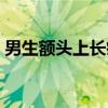 男生额头上长痘痘(额头长痘痘怎么办男生) 男生额头上长痘痘(额头长痘痘怎么办男生)