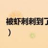 被虾刺刺到了手指疼痛（被虾刺到了手指疼痛）
