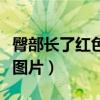 臀部长了红色疙瘩摸上去很疼(臀部长红疙瘩图片) 臀部长了红色疙瘩摸上去很疼(臀部长红疙瘩图片)