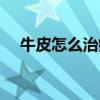 牛皮怎么治疗才能去根（牛皮怎样治疗）