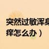 突然过敏浑身痒发红怎么回事（突然过敏全身痒怎么办）