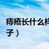 痔疮长什么样子的图片（蝴蝶臂的图片什么样子）