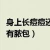 身上长痘痘还带有脓包图片（身上长痘痘还带有脓包）