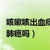 咳嗽咳出血痰是什么原因严重吗(咳嗽出血是肺癌吗) 咳嗽咳出血痰是什么原因严重吗(咳嗽出血是肺癌吗)