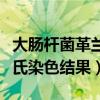 大肠杆菌革兰氏染色结果分析（大肠杆菌革兰氏染色结果）