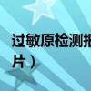 过敏原检测报告单模板（过敏原检测报告单图片）