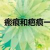 瘢痕和疤痕一样吗?（瘢痕和疤痕区别图片）