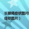 长眼疮症状图片眼睛反反复复的长疮是怎么回事?（长眼疮症状图片）