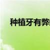 种植牙有弊端吗（种植牙有没有副作用）