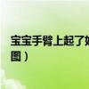 宝宝手臂上起了好多小疙瘩怎么回事（宝宝手臂上长小疙瘩图）