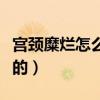宫颈糜烂怎么得的这种病（宫颈糜烂怎么得来的）