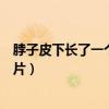 脖子皮下长了一个硬疙瘩是怎么回事（脖子皮下长硬疙瘩图片）