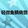 轻微鱼鳞病普遍吗（轻微鱼鳞皮肤病的图片）
