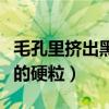毛孔里挤出黑色的硬粒图片（毛孔里挤出黑色的硬粒）