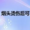 烟头烫伤后可以喝酒吗（烟头烫伤能当兵吗）