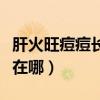 肝火旺痘痘长在脸的什么位置（肝火旺痘痘长在哪）