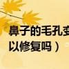 鼻子的毛孔变大了可以缩小吗（鼻子毛孔大可以修复吗）