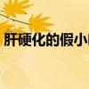 肝硬化的假小叶绘图（肝硬化假小叶手绘图）