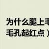 为什么腿上毛孔起红点不痛不痒（为什么腿上毛孔起红点）