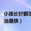 小孩长针眼怎么治最快方法（小孩长针眼怎么治最快）