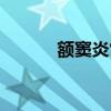 额窦炎常用药（额窦炎根治散）