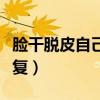 脸干脱皮自己会恢复吗（脸脱皮怎么办快速恢复）