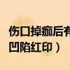 伤口掉痂后有凹陷红印怎么办(伤口掉痂后有凹陷红印) 伤口掉痂后有凹陷红印怎么办(伤口掉痂后有凹陷红印)