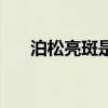 泊松亮斑是干涉还是衍射（泊松亮斑）