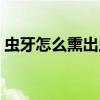 虫牙怎么熏出虫子（治虫牙的偏方熏出虫子）
