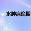 水肿病晚期病人病室的气味是（水肿病）