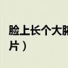 脸上长个大脓包硬不消（脸上长了个大脓包图片）