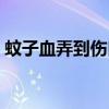 蚊子血弄到伤口上会感染艾滋病吗（蚊子血）