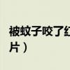 被蚊子咬了红疙瘩图片（被蚊子咬了起红点图片）