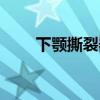 下颚撕裂器有卖的吗（下颚撕裂器）