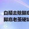 白醋去除脚底老茧硬块艾草的功效（白醋去除脚底老茧硬块）