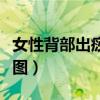 女性背部出痧反射区图解（女生背部出痧示意图）