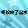 蚂蚁咬了起水泡图片（蚂蚁咬了会水泡图片）