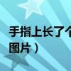 手指上长了个硬疙瘩图片（手指上起个硬疙瘩图片）