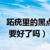 跖疣里的黑点出来了就好了吗（跖疣黑点浮出 要好了吗）