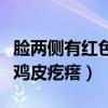 脸两侧有红色鸡皮疙瘩怎么治（脸两侧有红色鸡皮疙瘩）