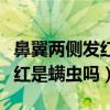 鼻翼两侧发红是螨虫吗怎么治疗（鼻翼两侧发红是螨虫吗）