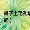 鼻子上毛孔堵塞怎么办（鼻子上毛孔堵塞有凸起）